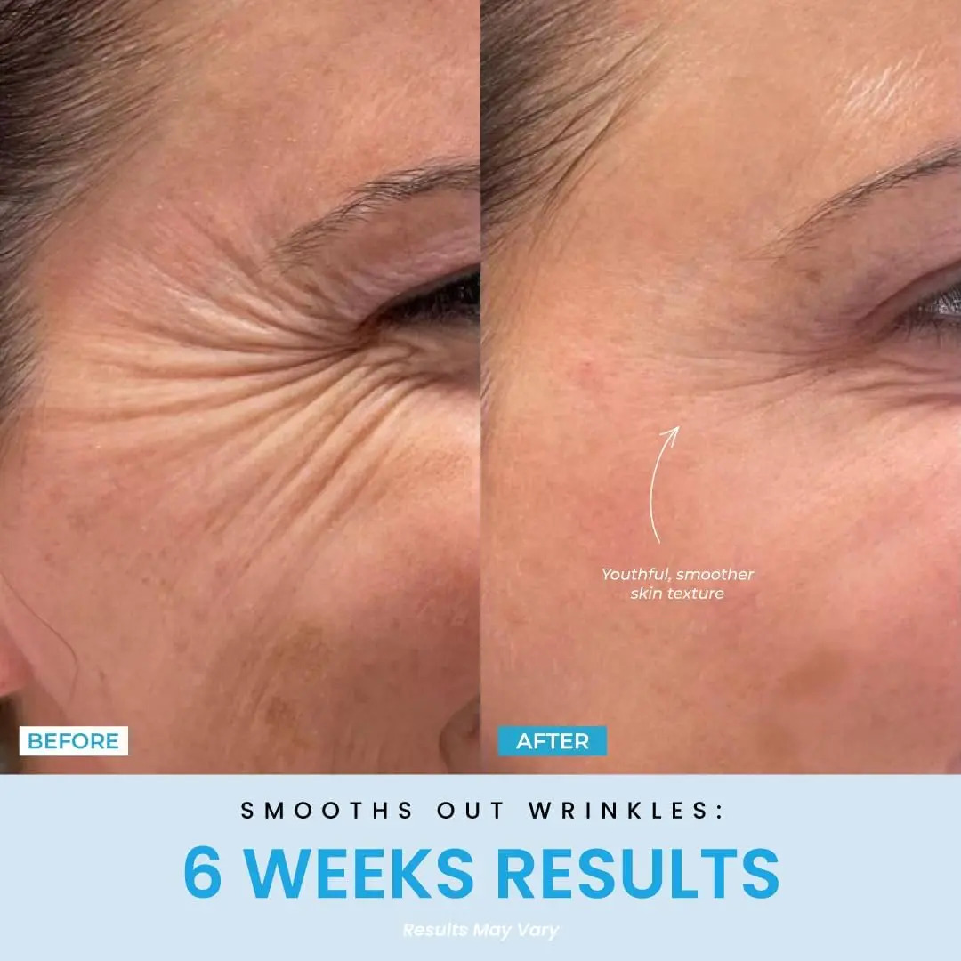 Masajeador Facial 3 En 1 Con Luz Roja, Mejora Arrugas Y Manc - Image 2