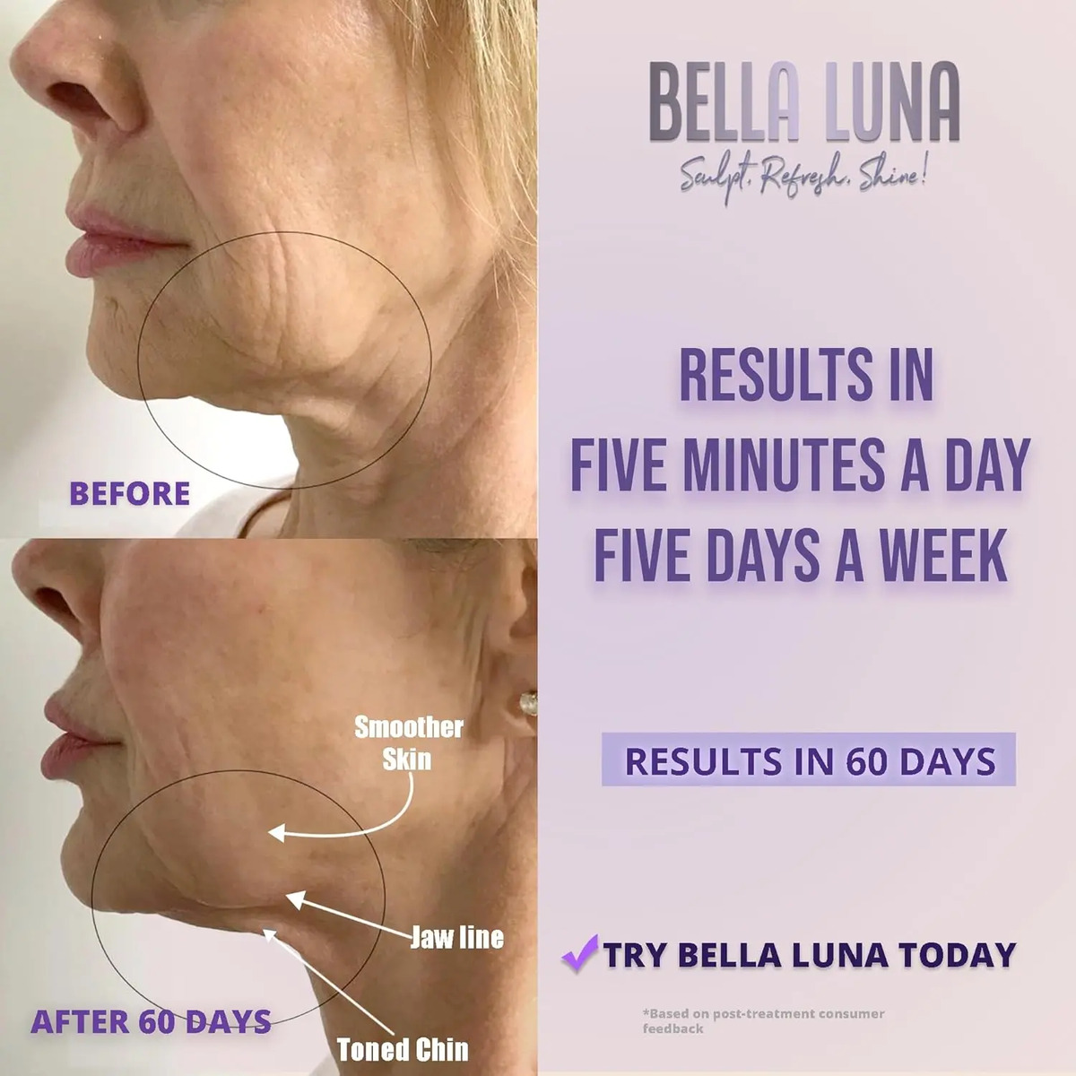 Dispositivo Facial 5 En 1 Para Tensar Y Reducir Arrugas En C - Image 3