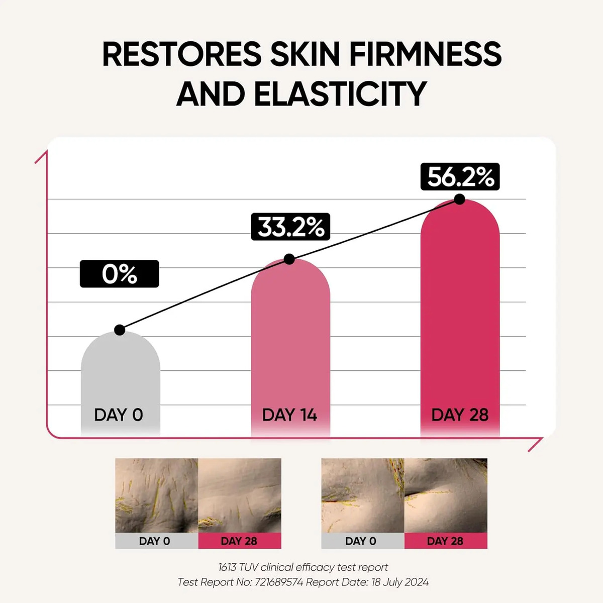 Terapia De Luz Led Facial 9 En 1 Para Rejuvenecer Piel En Ca - Image 8